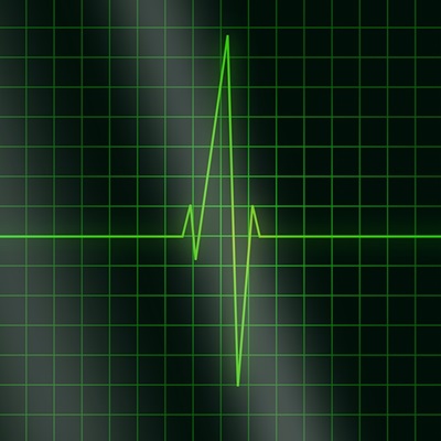 A green oscillation pattern.